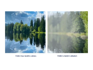 Poruchy zraku: Jak je vnímají lidé kolem nás?